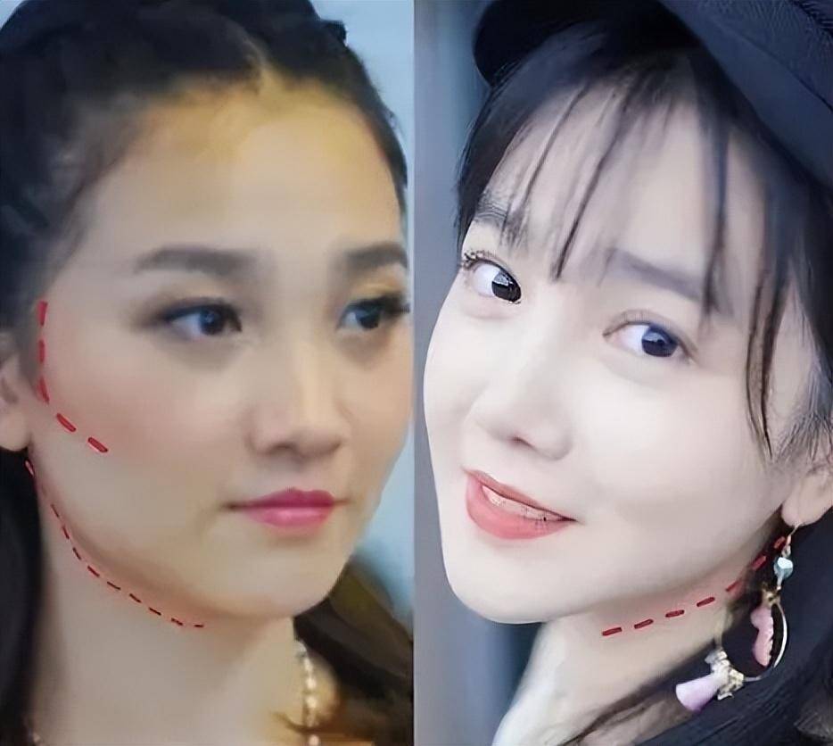 鞠婧祎四千年美人整容真相_女明星整容吗_娱乐圈整容明星